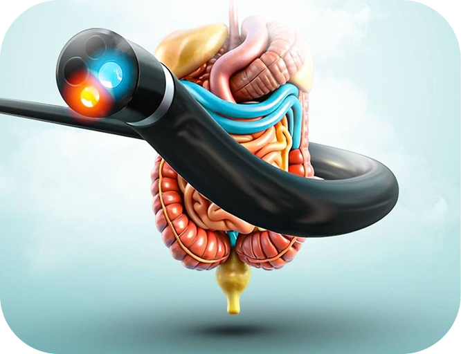 کولونوسکوپی